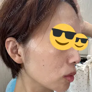 東京美容外科 東京美容外科 池袋院口コミ