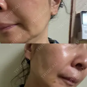 LIKI CLINIC KOBE口コミ