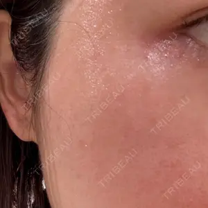 L‘amour clinic Tokyo【ラムールクリニック東京】口コミ