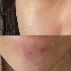 カノアクリニック 天神院口コミ