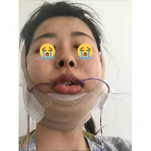 View美容整形外科口コミ