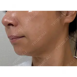 ゆきスキンクリニック 東池袋口コミ