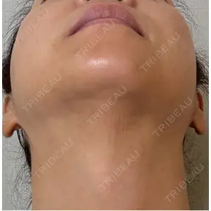 ゆきスキンクリニック 東池袋口コミ