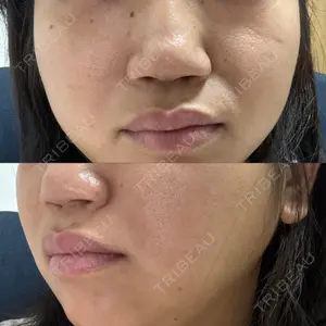 ルラ美容クリニック ルラ美容クリニック 広島院口コミ