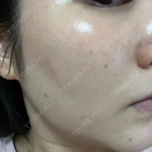 L‘amour clinic Tokyo【ラムールクリニック東京】口コミ