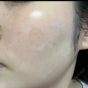 L‘amour clinic Tokyo【ラムールクリニック東京】口コミ