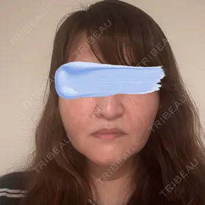 ゆきスキンクリニック 東池袋口コミ