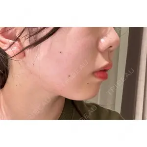 BITO BEAUTY CLINIC BITO BEAUTY CLINIC口コミ