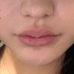 R Beauty CLINIC R Beauty CLINIC 銀座院口コミ