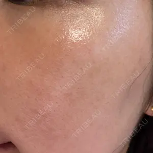 L‘amour clinic Tokyo【ラムールクリニック東京】口コミ