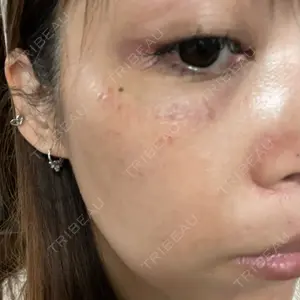 ルラ美容クリニック ルラ美容クリニック 札幌本院口コミ