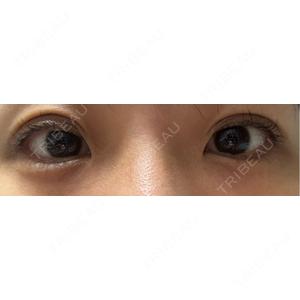 NARU Beauty Clinic NARU Beauty Clinic 【ナルクリ】口コミ