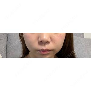 BWC ビューティーウィルクリニック（旧：BWC ビューティー和心クリニック）口コミ