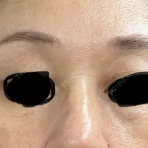 TCB東京中央美容外科 TCB東京中央美容外科 渋谷西口院口コミ