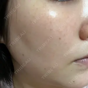 L‘amour clinic Tokyo【ラムールクリニック東京】口コミ