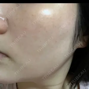 L‘amour clinic Tokyo【ラムールクリニック東京】口コミ