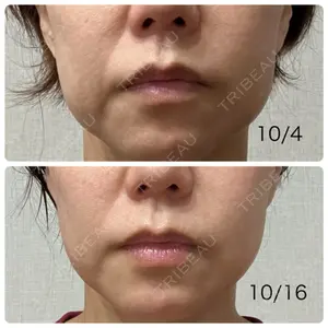 椿クリニック 椿クリニック 心斎橋院口コミ