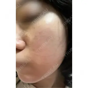 BITO BEAUTY CLINIC BITO BEAUTY CLINIC口コミ