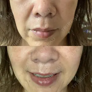 ASTRA BEAUTY CLINIC口コミ