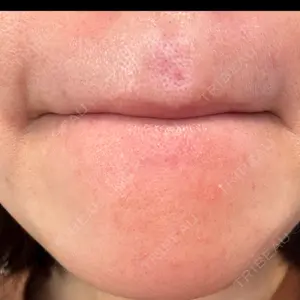 L‘amour clinic Tokyo【ラムールクリニック東京】口コミ