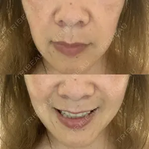 ASTRA BEAUTY CLINIC口コミ