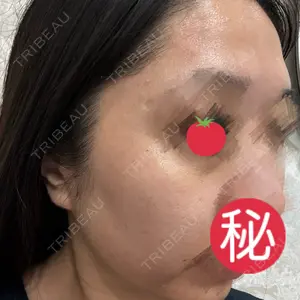おおかみ美容のクリニック おおかみ美容のクリニック 新宿院口コミ
