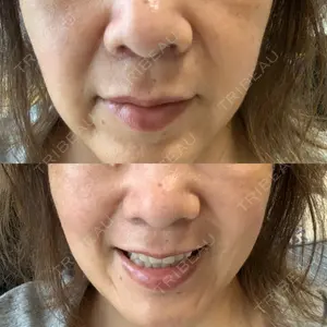 ASTRA BEAUTY CLINIC口コミ