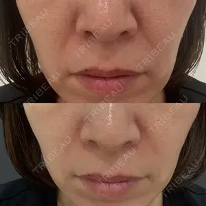 NARU Beauty Clinic NARU Beauty Clinic 【ナルクリ】 水戸院口コミ