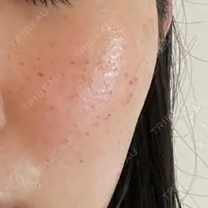 ゆきスキンクリニック 東池袋口コミ