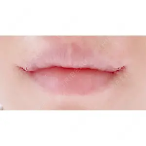 口コミ
