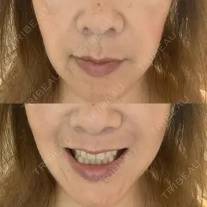 ASTRA BEAUTY CLINIC口コミ