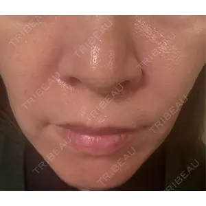 NARU Beauty Clinic NARU Beauty Clinic 【ナルクリ】 水戸院口コミ