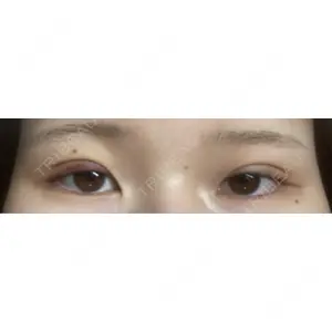 大塚美容形成外科 大塚美容形成外科 銀座本院口コミ