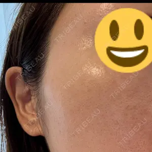 L‘amour clinic Tokyo【ラムールクリニック東京】口コミ