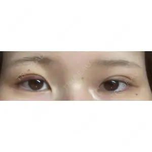 大塚美容形成外科 大塚美容形成外科 銀座本院口コミ