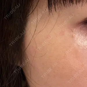 L‘amour clinic Tokyo【ラムールクリニック東京】口コミ