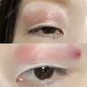 口コミ