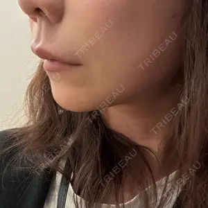 ルラ美容クリニック ルラ美容クリニック 渋谷本院口コミ