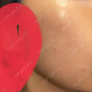 おおかみ美容のクリニック おおかみ美容のクリニック 新宿院口コミ