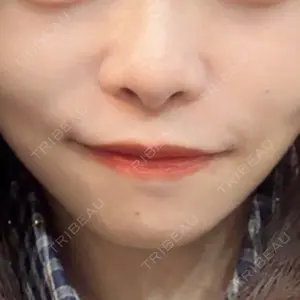 東京シンデレラ美容外科 東京シンデレラ美容外科 池袋院口コミ