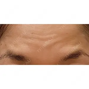 TCB東京中央美容外科 TCB東京中央美容外科 大宮東口院口コミ