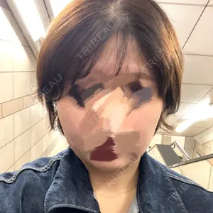 ゆきスキンクリニック 東池袋口コミ