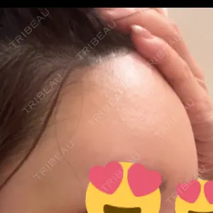 plume clinic plume clinic口コミ