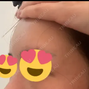 plume clinic plume clinic口コミ