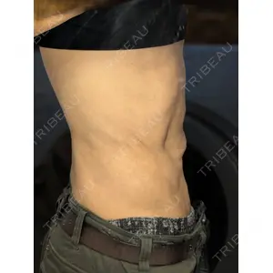 脂肪吸引の森クリニック 脂肪吸引の森クリニック東京院口コミ