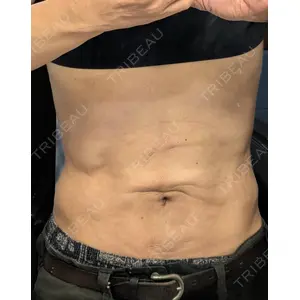 脂肪吸引の森クリニック 脂肪吸引の森クリニック東京院口コミ