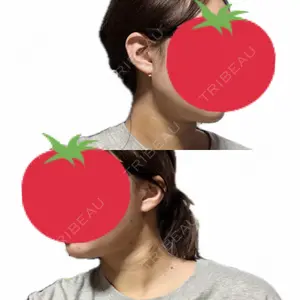 東京ココセランクリニック口コミ