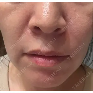 NARU Beauty Clinic NARU Beauty Clinic 【ナルクリ】 水戸院口コミ