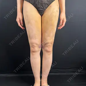 藤・ナチュレ美容クリニック 藤・ナチュレ美容クリニック 銀座院口コミ