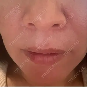 NARU Beauty Clinic NARU Beauty Clinic 【ナルクリ】 水戸院口コミ